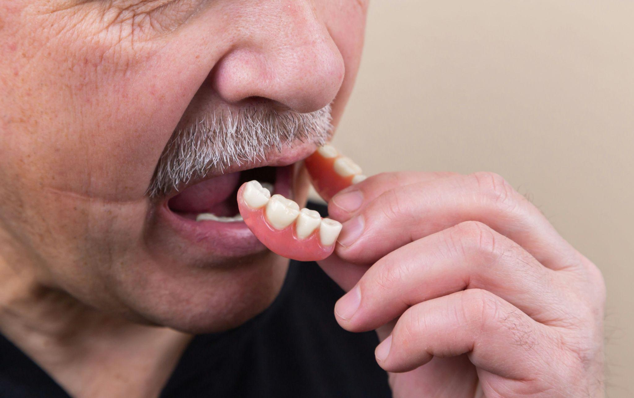 A senior examines dentures with coverage from senior dental plans in California.
