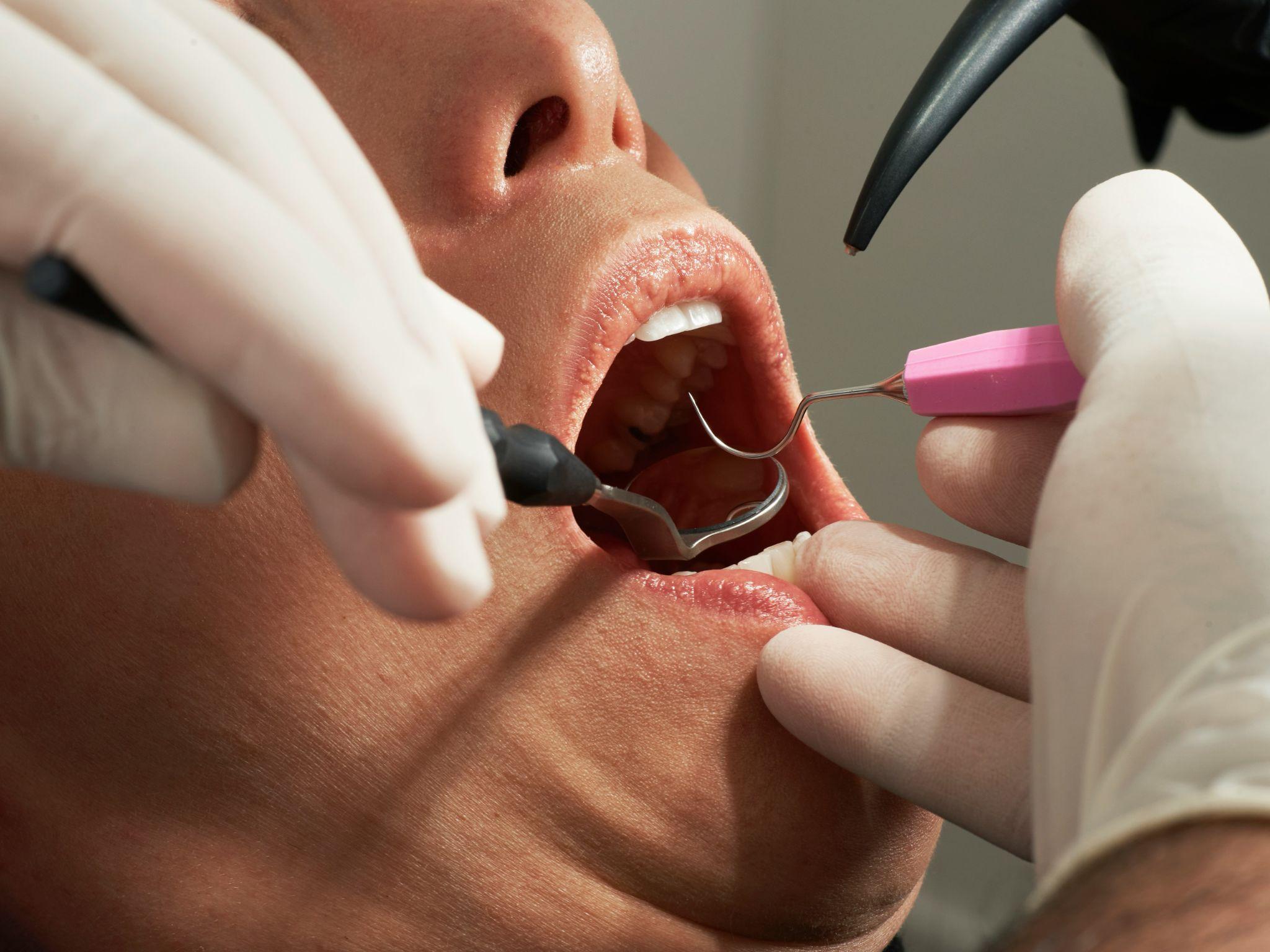 A patient receives a dental examination with senior dental insurance plans in California.